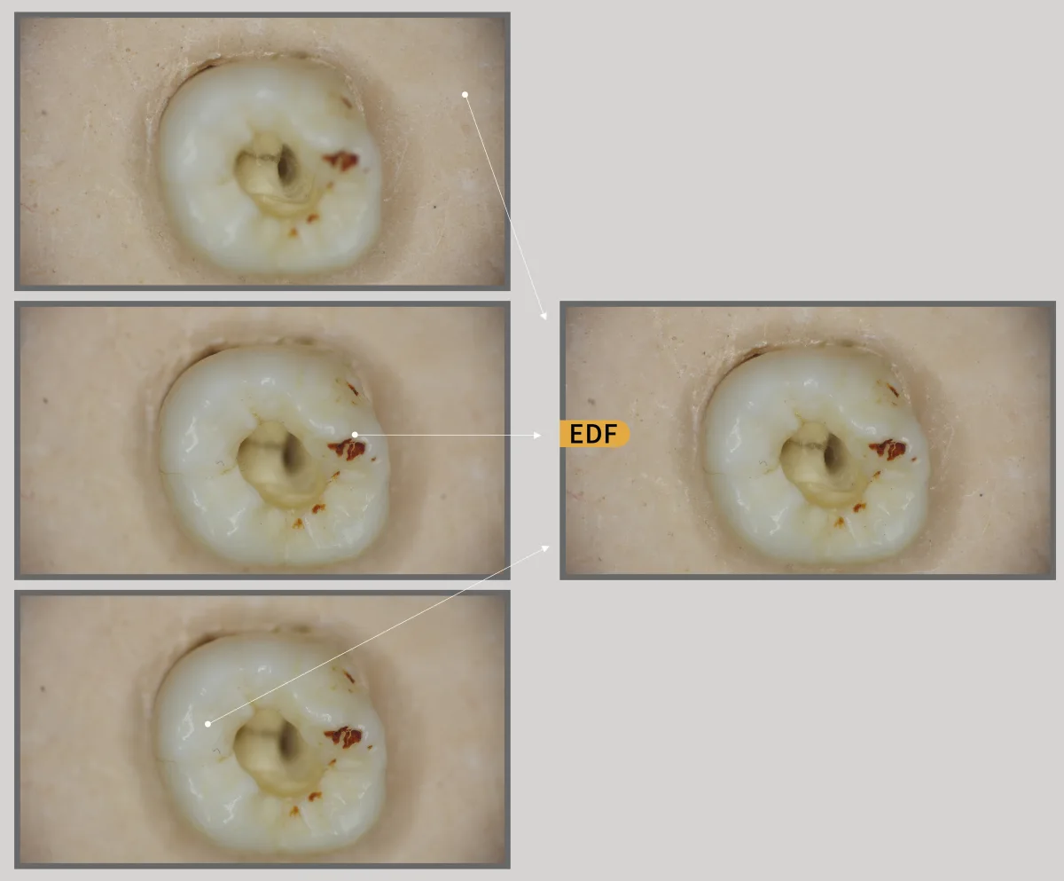 Teeth with extended depth of field