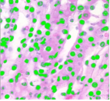 How to use image segmentation and counting