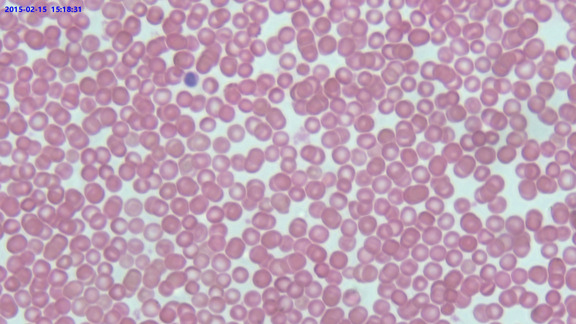 Pathological Slide Observation