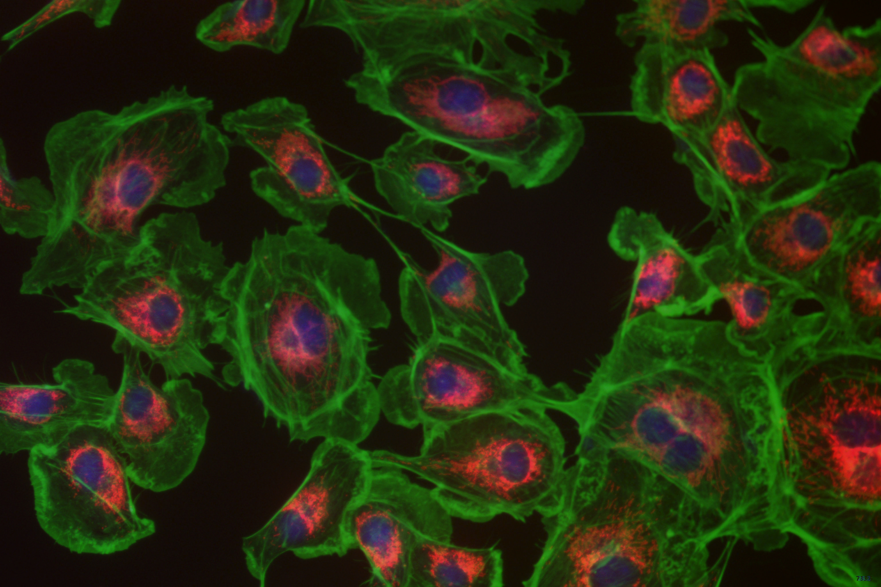 Intelligent Vision-Guided Systems in Cell Culture Detection