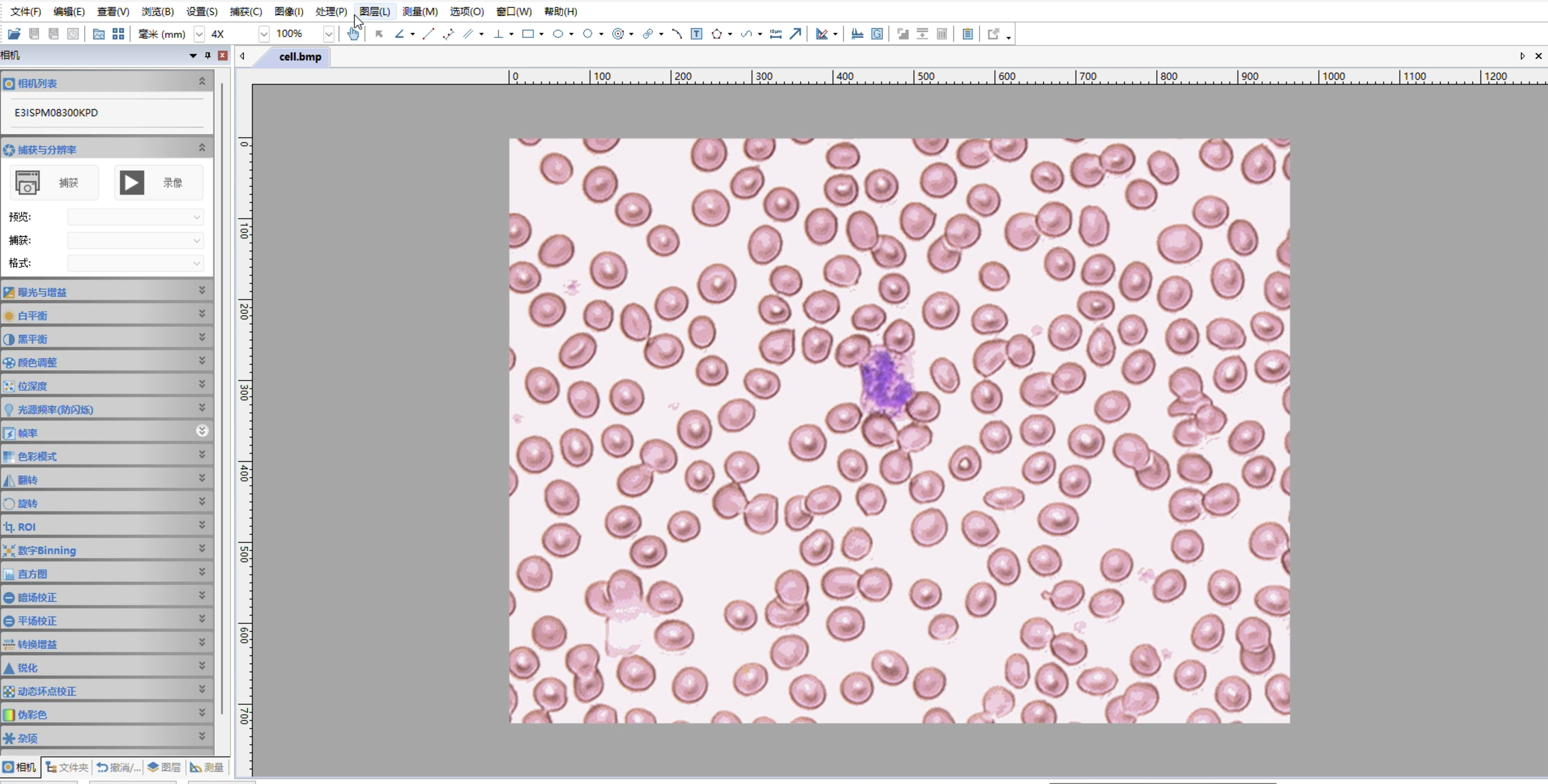OTSU Automatic Segmentation Counting Tutorial